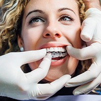 Patient at dental office front desk paying for Clear Aligners