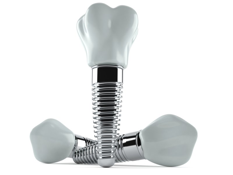 multiple titanium dental implants